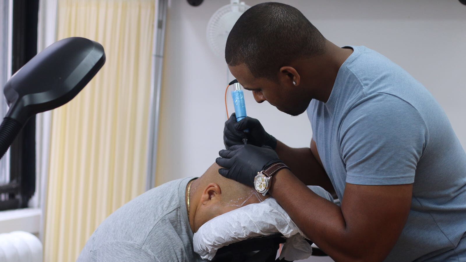 Which are the benefits of Scalp micropigmentation?